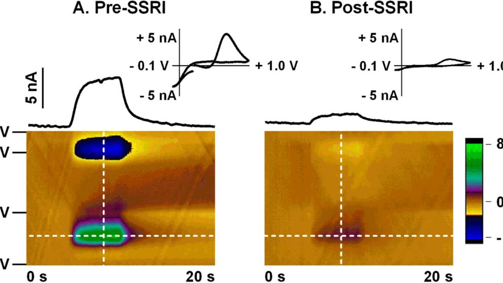 SSRIs decrease redox current of serotonin in a flow cell when the Jackson waveform is used.